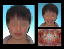 �ʐ^�F�ԕȗ�