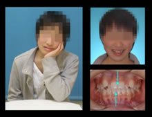 �ʐ^�F�ԕȗ�