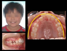 �ʐ^�F�ԕȗ�