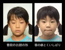 写真:態癖により歪んだ全身例