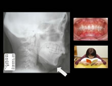 写真:態癖により歪んだ全身例